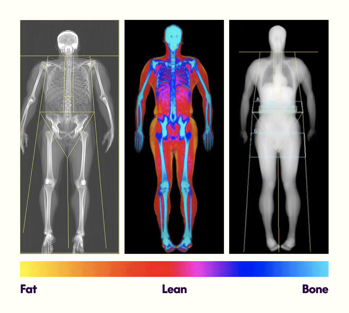 Three images showing different types of scans of a human body with a color bar indicating fat, lean, and bone.
